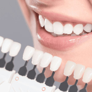 Tooth whitening