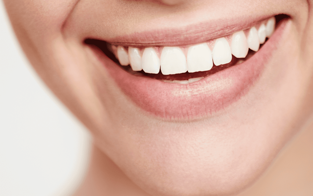 Replacing Missing Teeth and Restoring Your Smile