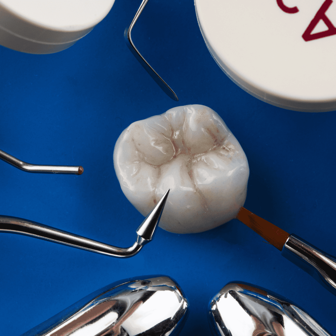 Dental crown in Brisbane laboratory